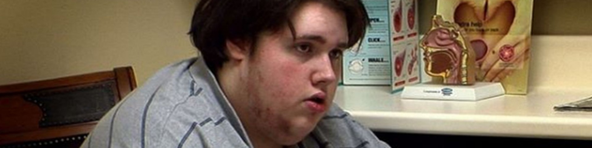 Chi è il ragazzo di 380 chili?