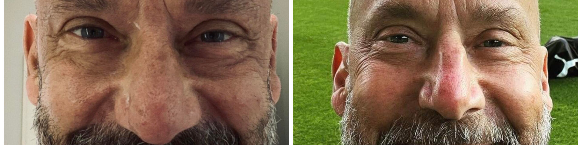 Gianluca Vialli ricoverato a Londra in gravi condizioni